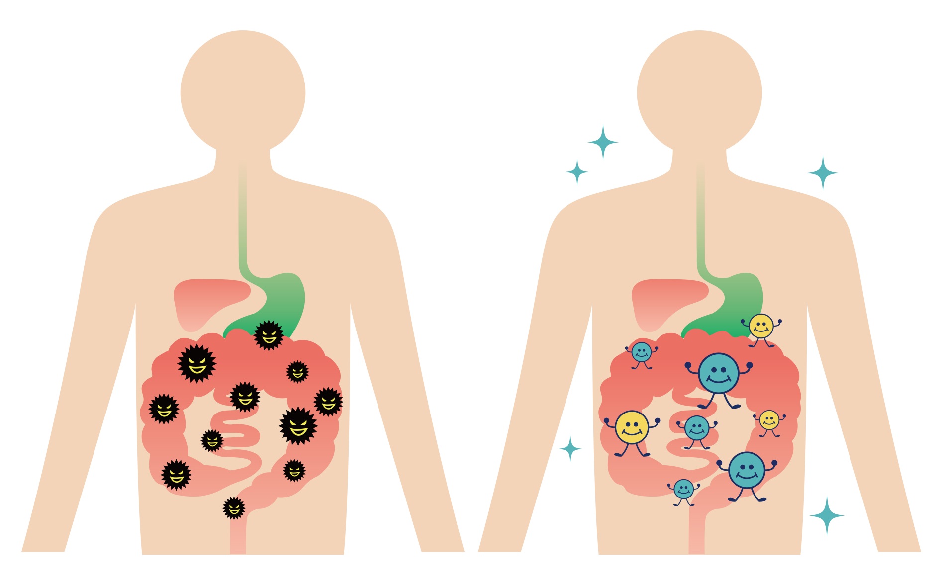 便秘と腰痛を招く日常習慣に注意